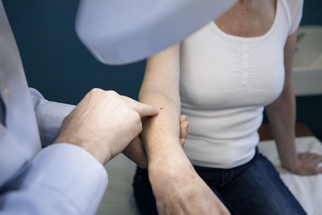 Skin Cancer Information